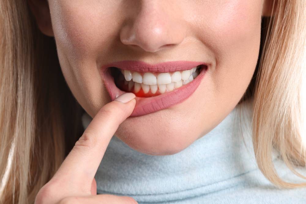 Periodontia Tratamento de Gengiva Vargem grande do Sul -SP