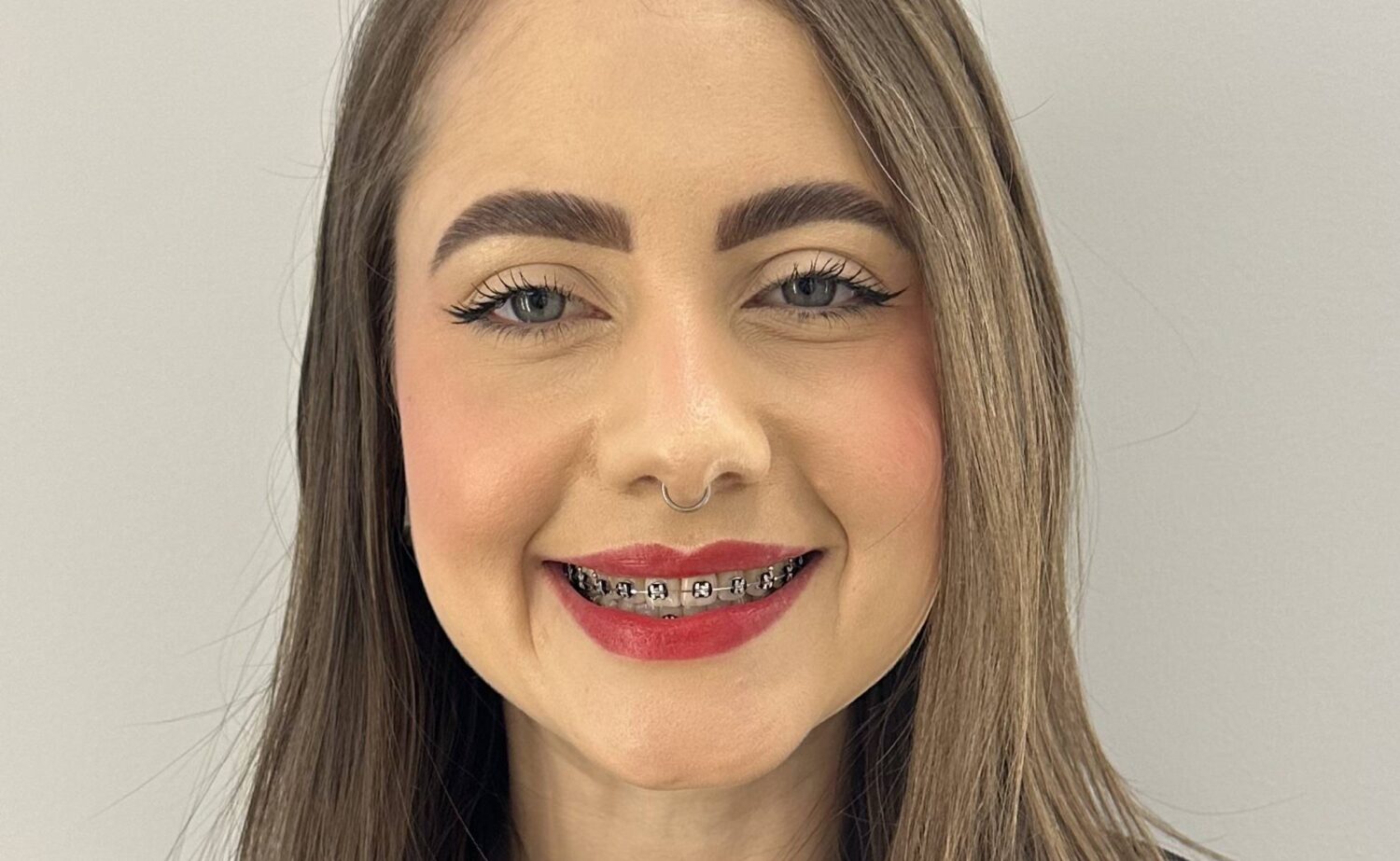 Aparelho dental Vargem Grande do Sul