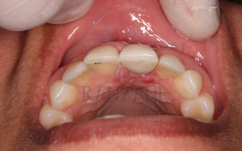 Implantes Dentários Vargem grande do Sul -SP